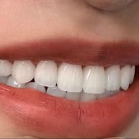 Nha Khoa Pearl Smile